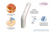 What is the inFlow - Vesiflo